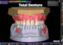 design dental devices using exocad and meshmixer